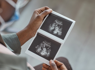 Ultraschallbild eines Babys 